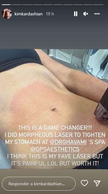 Kim Kardashian faz cirurgia em estômago