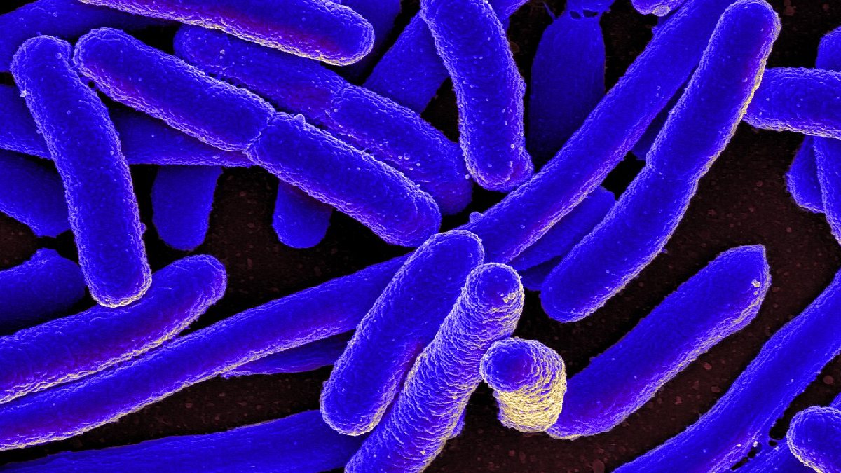Bactéria Bacillus cereus é grande vilã da vez. Imagem: NIAID/Wikimedia Commons