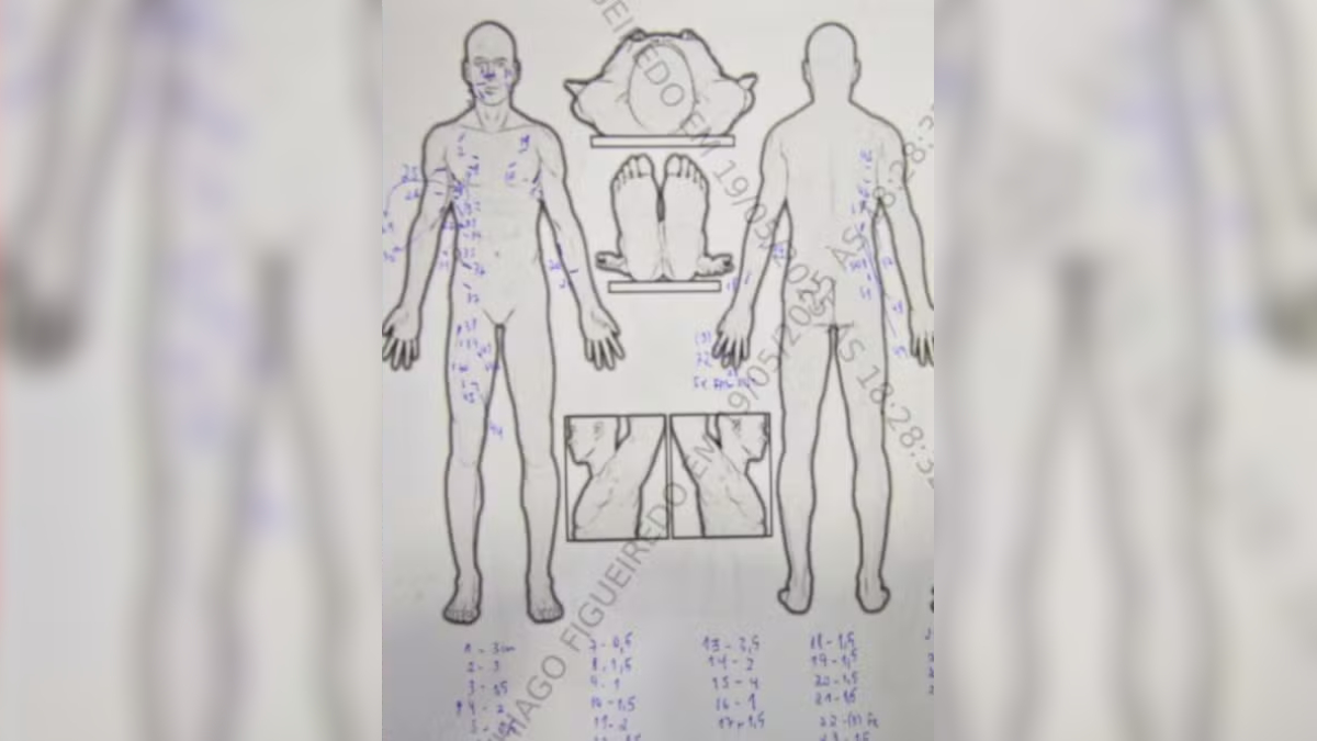 Laudo do Instituto Médico Legal (IML) mostram os locais em que Amanda recebeu diversas facadas.