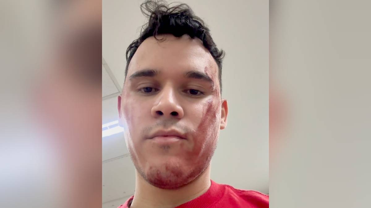 Alexandre Edward disse que só conseguiu atendimento para os familiares após invadir o gramado para pedir ajuda e que o atendimento ocorreu somente após o término da partida. Reprodução/Instagram