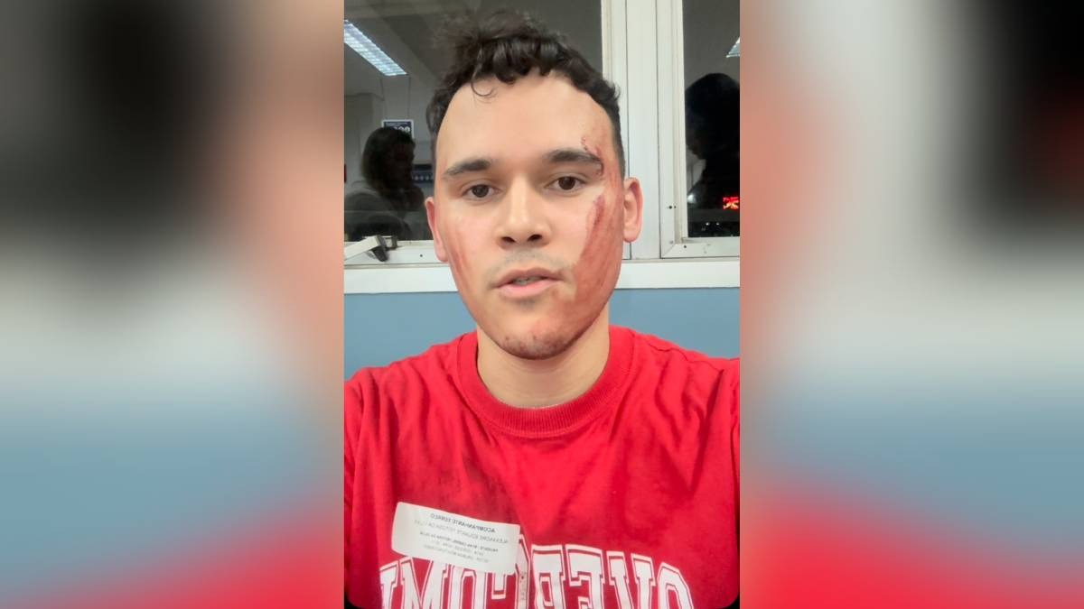 "Tive que manchar a cara com o sangue do meu pai, para pedir socorro", disse Alexandre Edward. Reprodução/Instagram