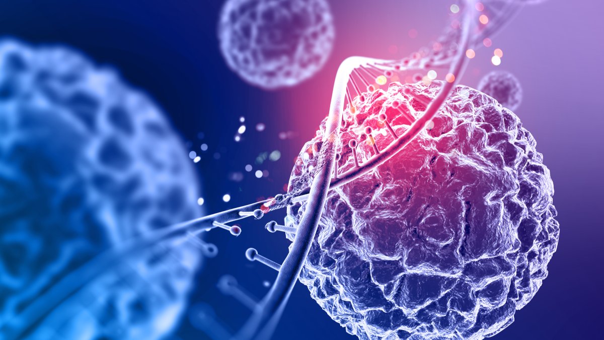 Histotripsia pode ser repetida e fortalece o sistema imunológico após as sessões