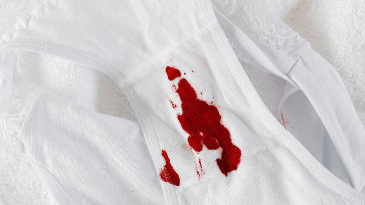 Sangramento anal abundante Sangue escorrendo pelas pernas ao ir ao banheiro.