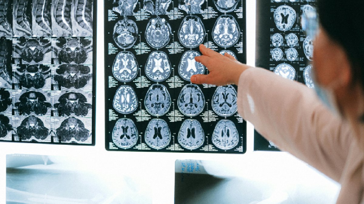 Em janeiro de 2021, uma senhora de 64 anos, no sudeste de Nova Gales do Sul na Austrália começou a apresentar dores abdominais, diarreia, febre, tosse e falta de ar. após exames realizados, nenhum parasita foi encontrado no corpo da paciente. Em 2022, a mesma mulher que não quis ser identificada começou a ter esquecimentos, dificuldades no processamento do pensamento e depressão. Foi então que uma ressonância magnética revelou uma "lesão atípica" em seu cérebro. Foto: Reprodução/Pexels