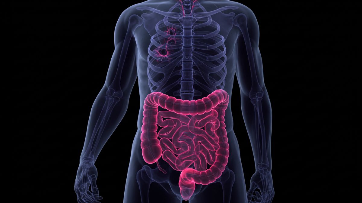 Conservantes e aromatizantes intensificam o risco e podem mascarar problemas mais sérios no intestino (Imagem gerada por IA)