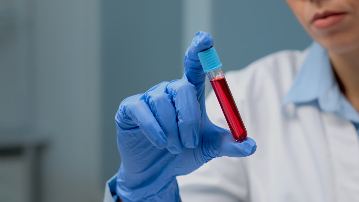 Análise é feita a partir de hemograma, exame rotineiro em muitas clínicas