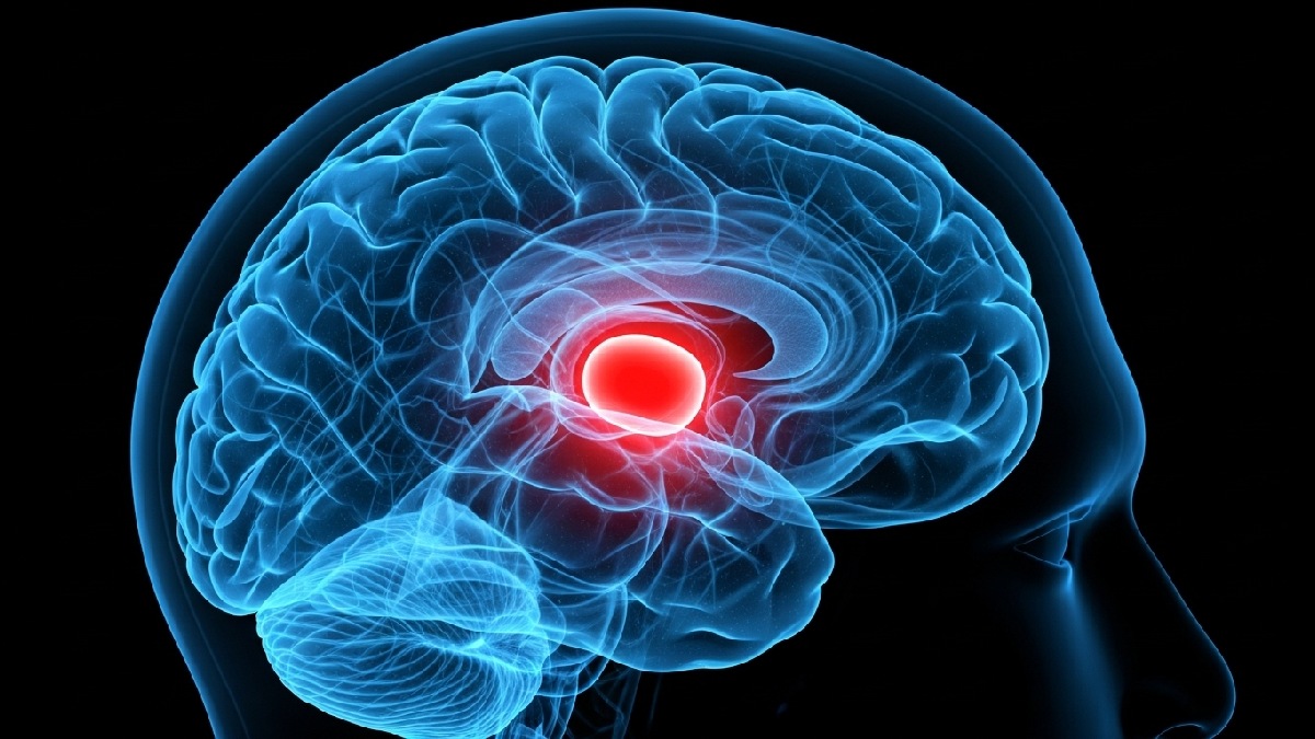 Melatonina é produzina naturalmente na glândula pineal. Imagem gerada por inteligência artificial
