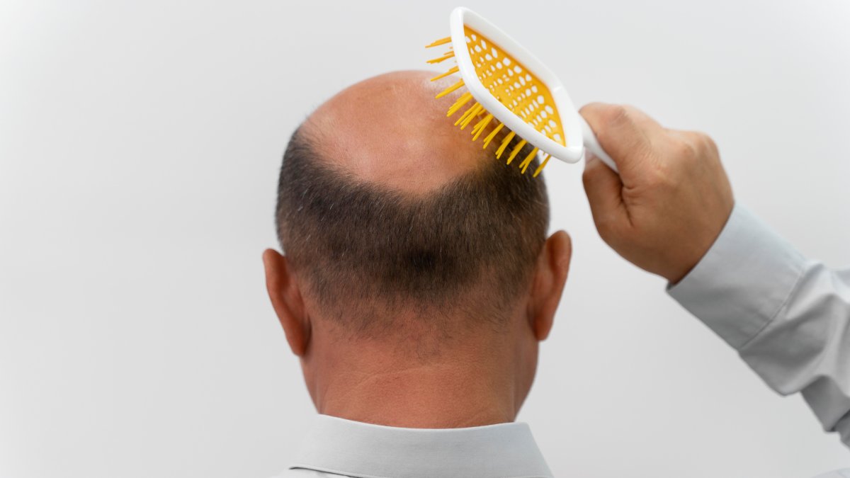 Nos testes, o método garantiu maior absorção e crescimento mais rápido dos fios em comparação ao minoxidil tradicional