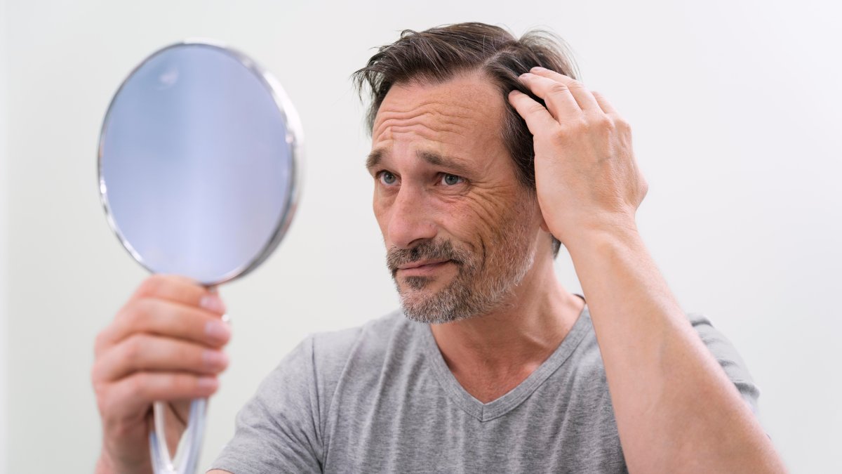 Pesquisadores descobriram que a estévia pode potencializar o efeito do minoxidil e acelerar o crescimento capilar