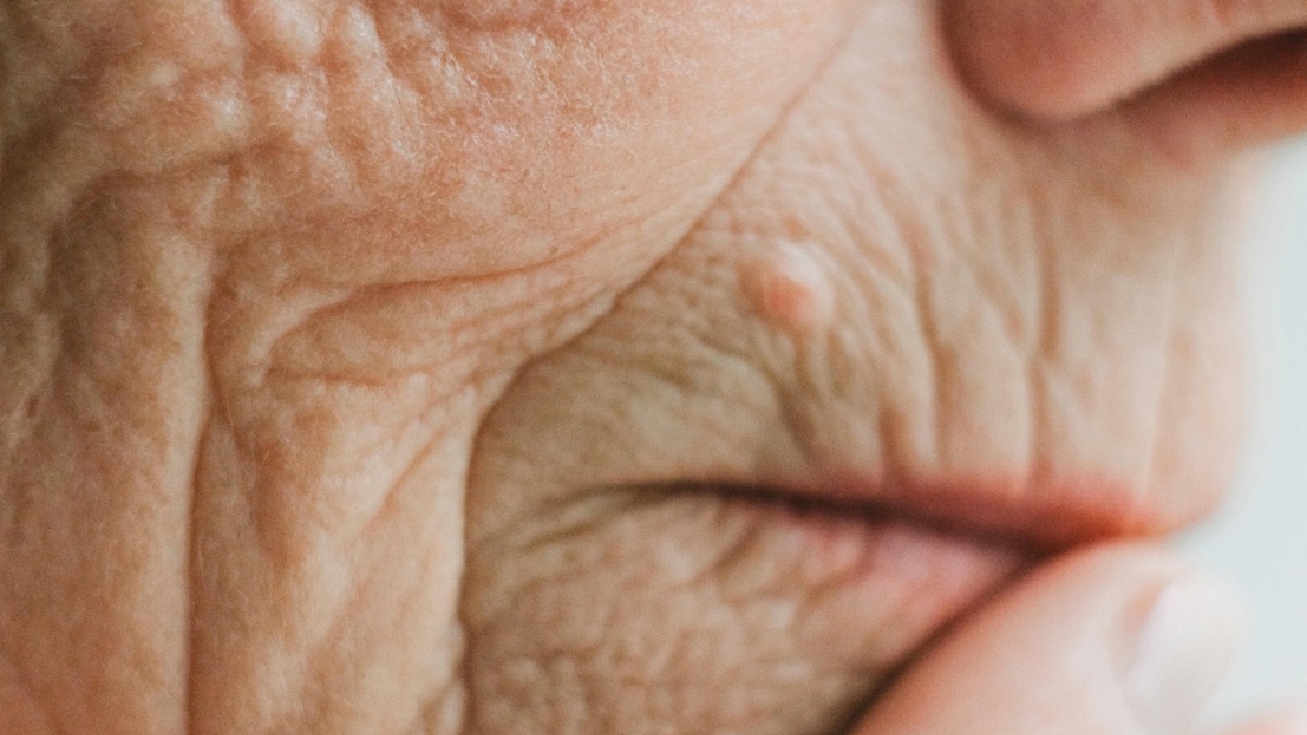 O cheiro 2-nonena é causado pela oxidação da pele. Imagem: Pexels