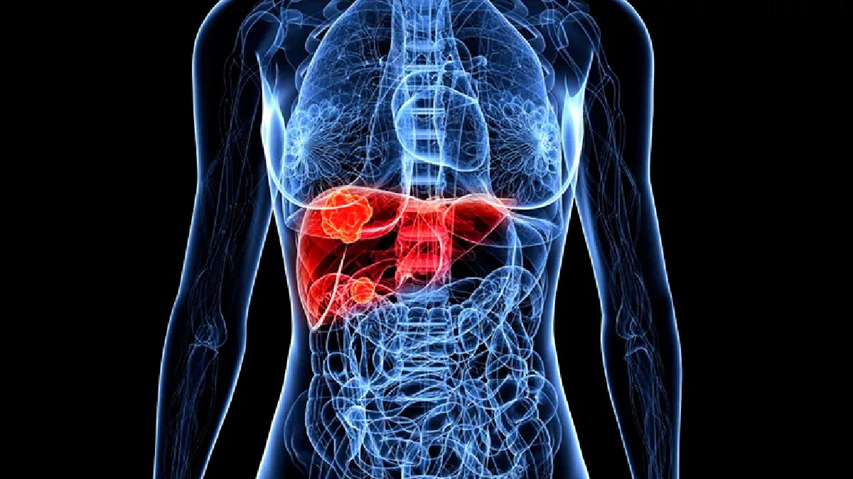 A eficácia de produtox detox comerciais não é comprovada pela ciência. Imagem: Reprodução Tesla Diagnóstico por Imagem