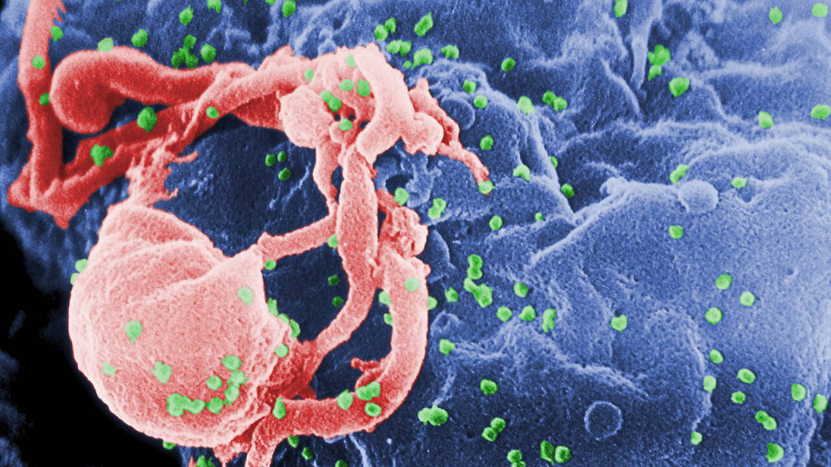 Micrografia eletrônica de varredura do HIV-1 em processo de brotamento (em verde) a partir de um linfócito cultivado. Esta imagem foi colorizada para destacar características importantes. Foto: Wikimedia Commons