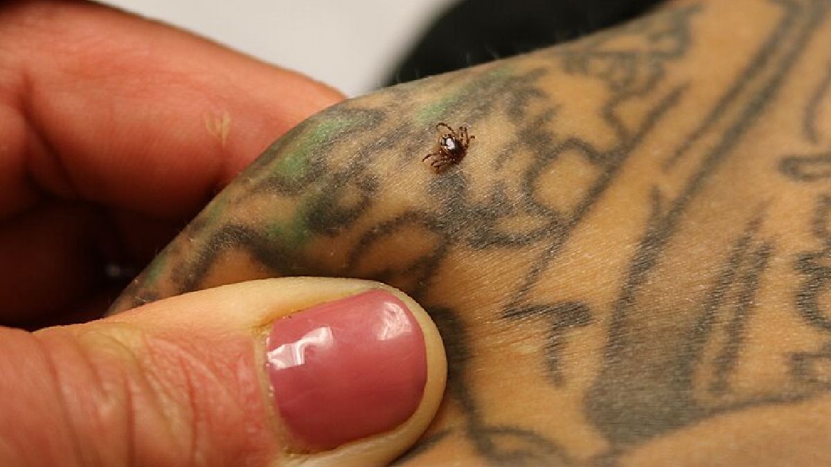 Em caso de encontro, NÃO REMOVA COM AS UNHAS! Pressione a área como na imagem e, com o auxílio de uma pinça, remova o animal com as pontas o mais rentes à pele possível para evitar a decapitação do animal ou que ele regurgite dentro da pele, liberando mais patógenos (Foto: NIAID / Wikimedia Commons)