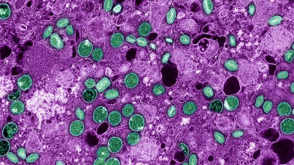 A vacina contra a varíola humana, usada até os anos 1980, oferece proteção cruzada contra a mpox, segundo estudos epidemiológicos. Foto: Wikimedia Commons