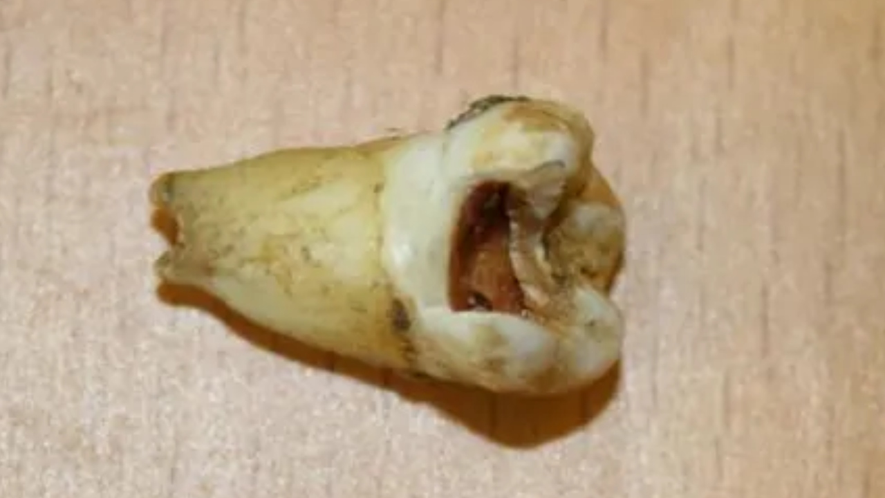 Outro objeto que chamou atenção foi um dente de John Lennon. Foto: Divulgação/Omega Auctions