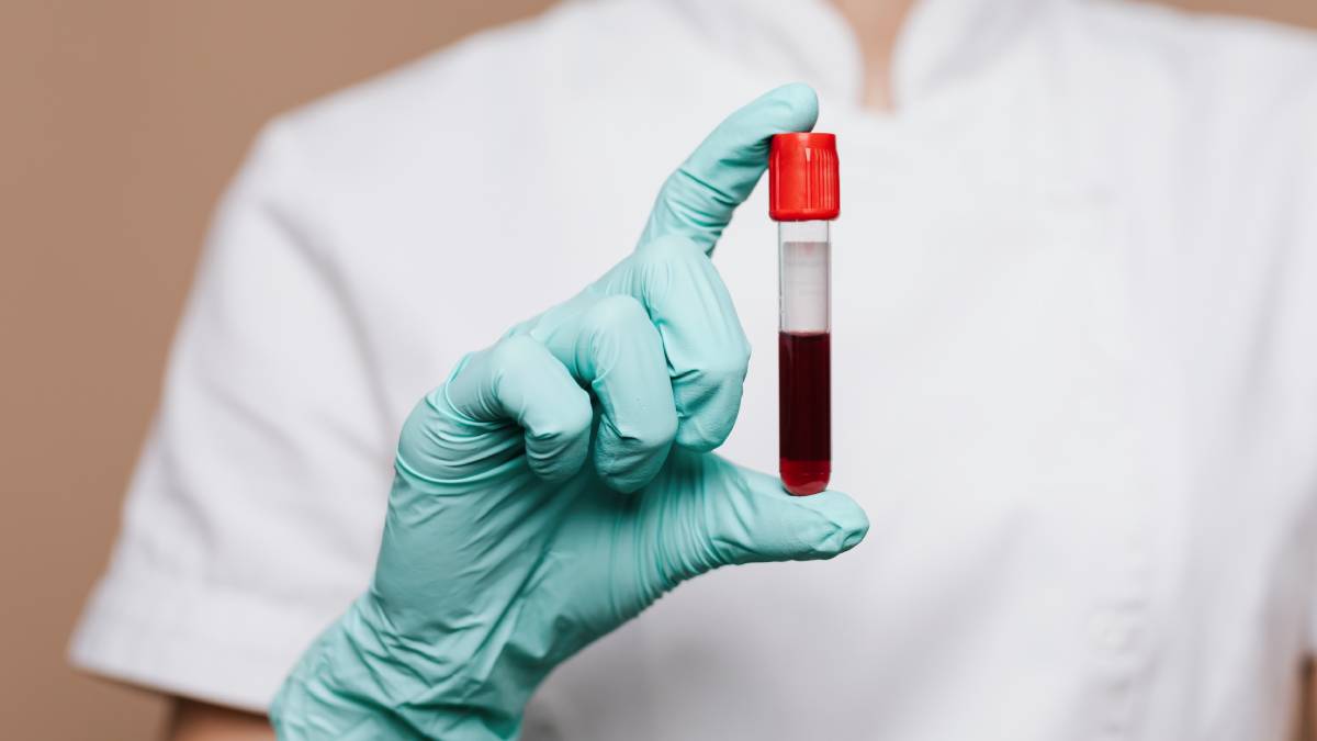 Em alguns frascos, o sangue se separa em camadas após o processamento, o que ajuda em diferentes tipos de análise (Foto: Freepik)