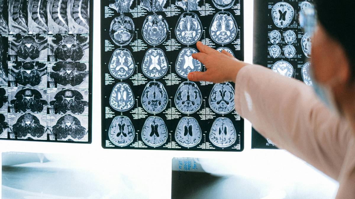 Especialistas discutem os avanços e os desafios éticos das tecnologias que conectam o cérebro humano a sistemas digitais.