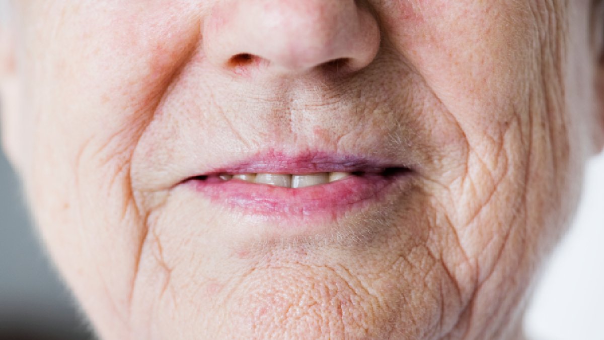 Com o passar dos anos, os pelos do nariz podem parecer mais longos e visíveis devido a mudanças hormonais e ao ciclo natural de crescimento dos fios, mas o auge é entre 40 e 50 anos