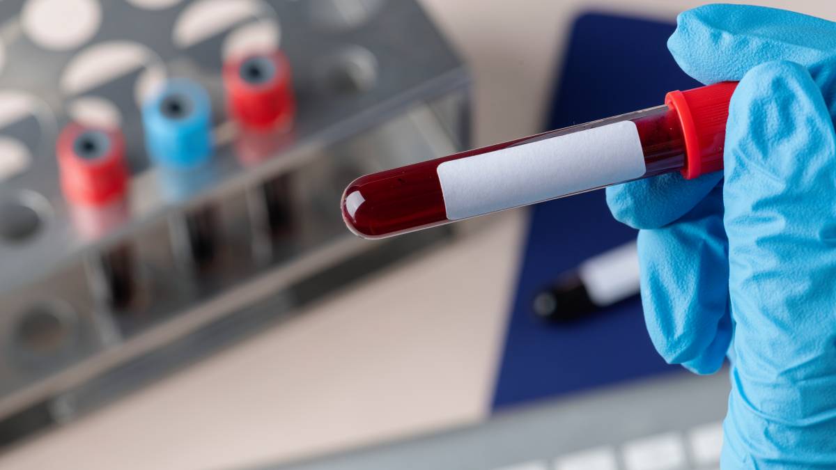 Tubos de coleta diferentes podem ser usados conforme o tipo de análise pedida no laboratório (Foto: Freepik)