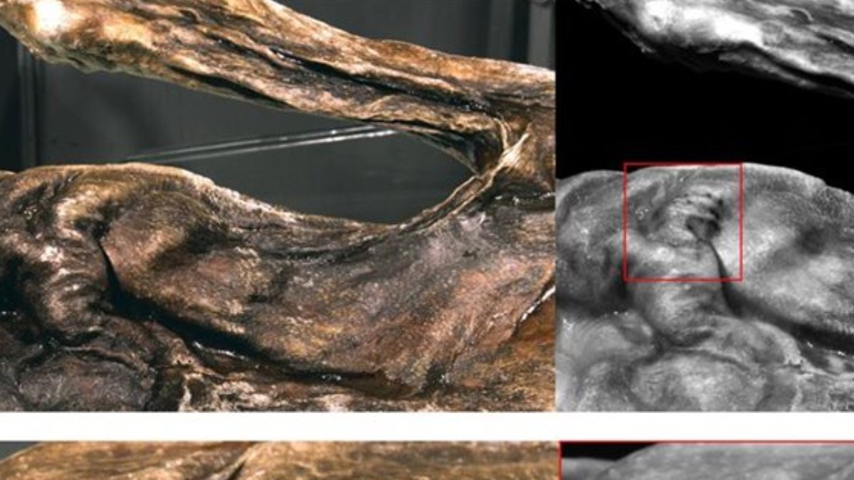 Mesmo na pré-história, Ötzi já apresentava predisposição a doenças modernas, evitadas graças a um estilo de vida ativo e alimentação equilibrada (Foto: MARCO SAMADELLI / EURAC / SOUTH TYROL MUSEUM OF ARCHAEOLOGY)