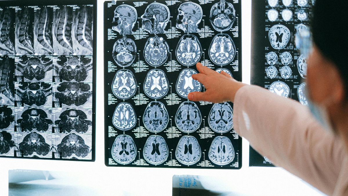 Descoberta abre novas frentes para estudos sobre prevenção e futuros tratamentos contra a doença (Foto: Freepik)