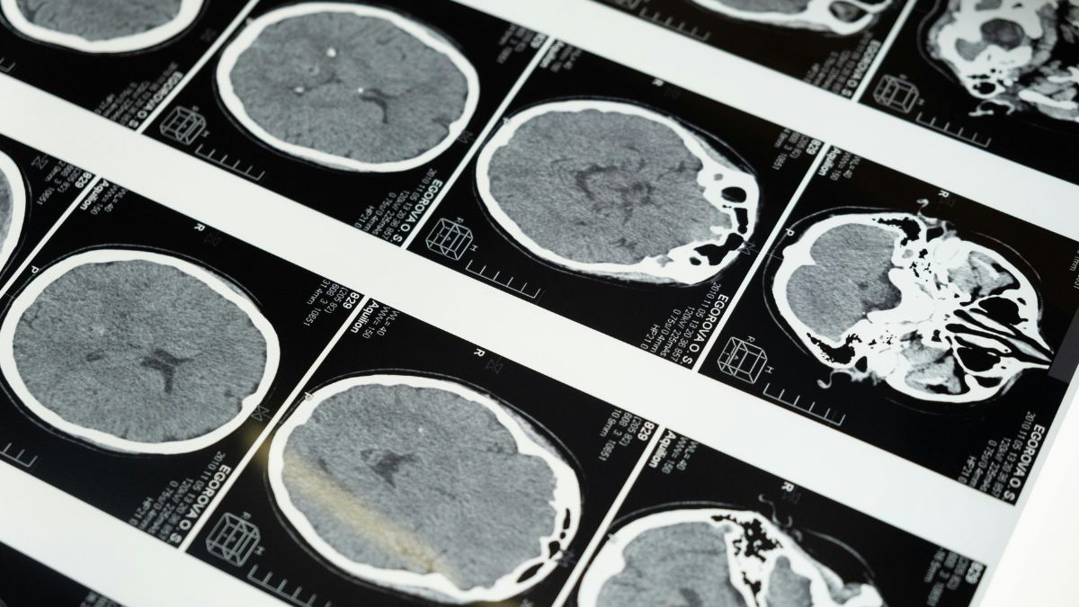 Nem sempre sinais biológicos e sintomas caminham no mesmo ritmo, e essa é uma das ideias mais fortes do estudo (Foto: Freepik)