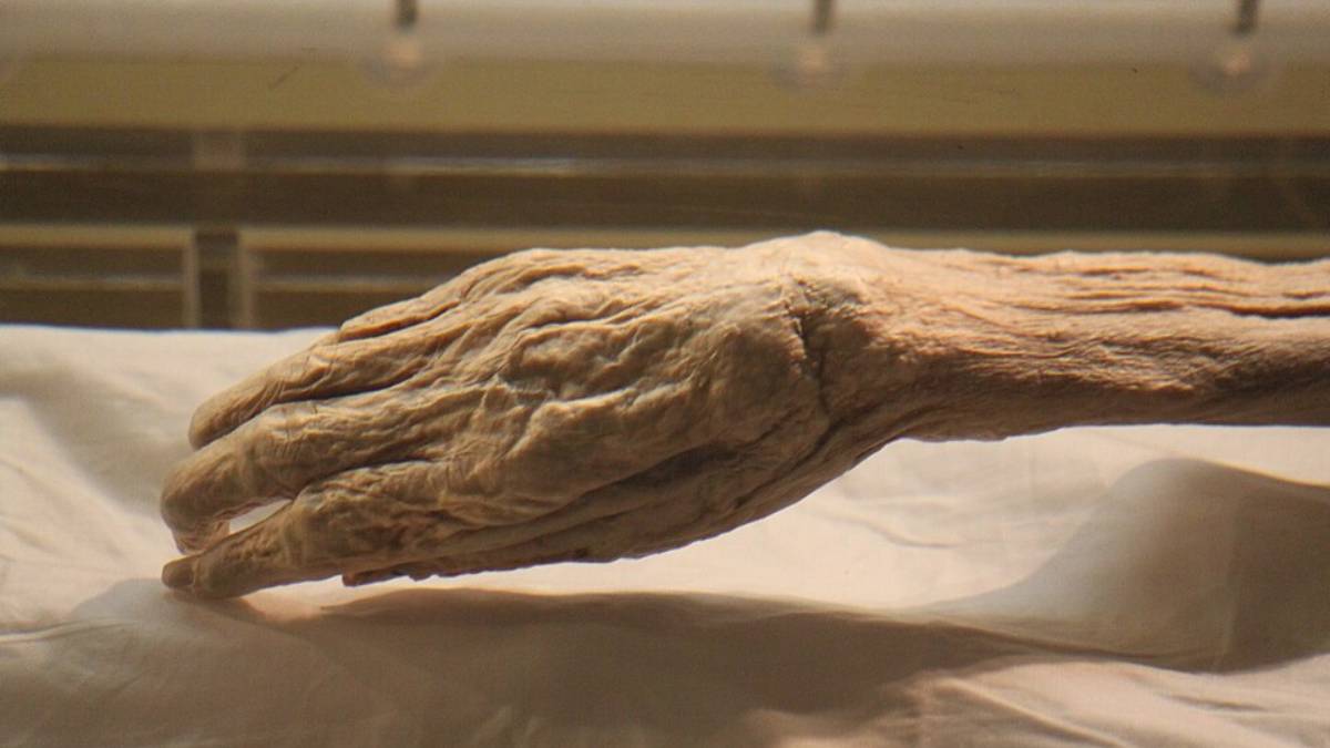 Um corpo com mais de 2 mil anos ainda guarda detalhes impressionantes (Foto: Gary Todd/ Wikimedia Commons)