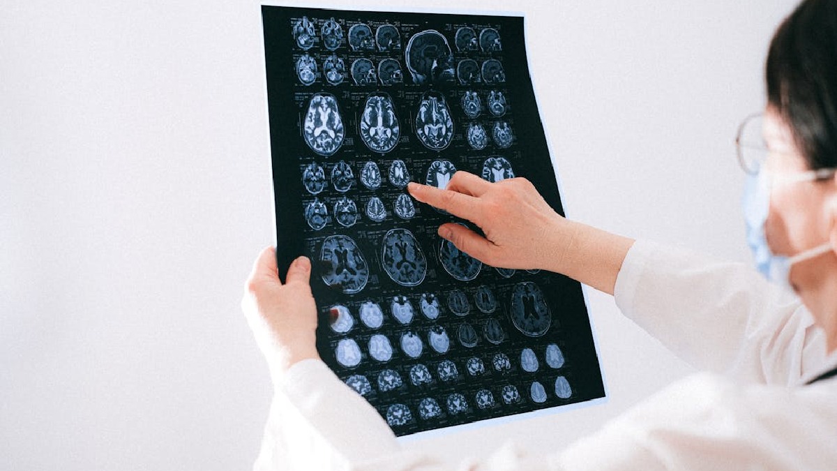 Exames de imagem ajudam a confirmar o AVC, localizar a área atingida e separar o quadro de outras emergências neurológicas (Foto: Anna Shvets / Pexels)
