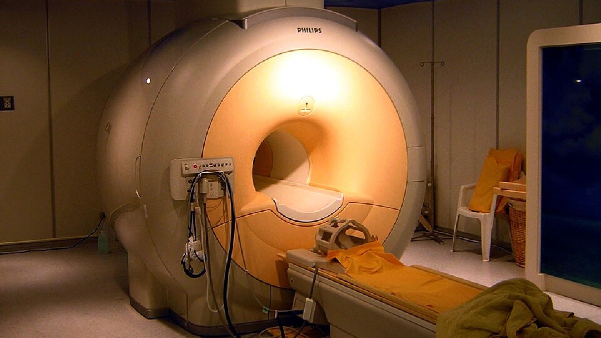 Equipamentos de ressonância de alto campo ampliam o detalhamento das imagens cerebrais quando a origem do AVC permanece sem explicação imediata (Foto: KasugaHuang / Wikimedia Commons)