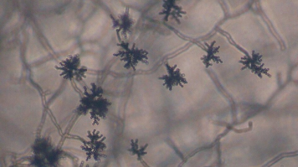 Registros de espécime do gênero Cladosporium (Foto: Wikimedia Commons)