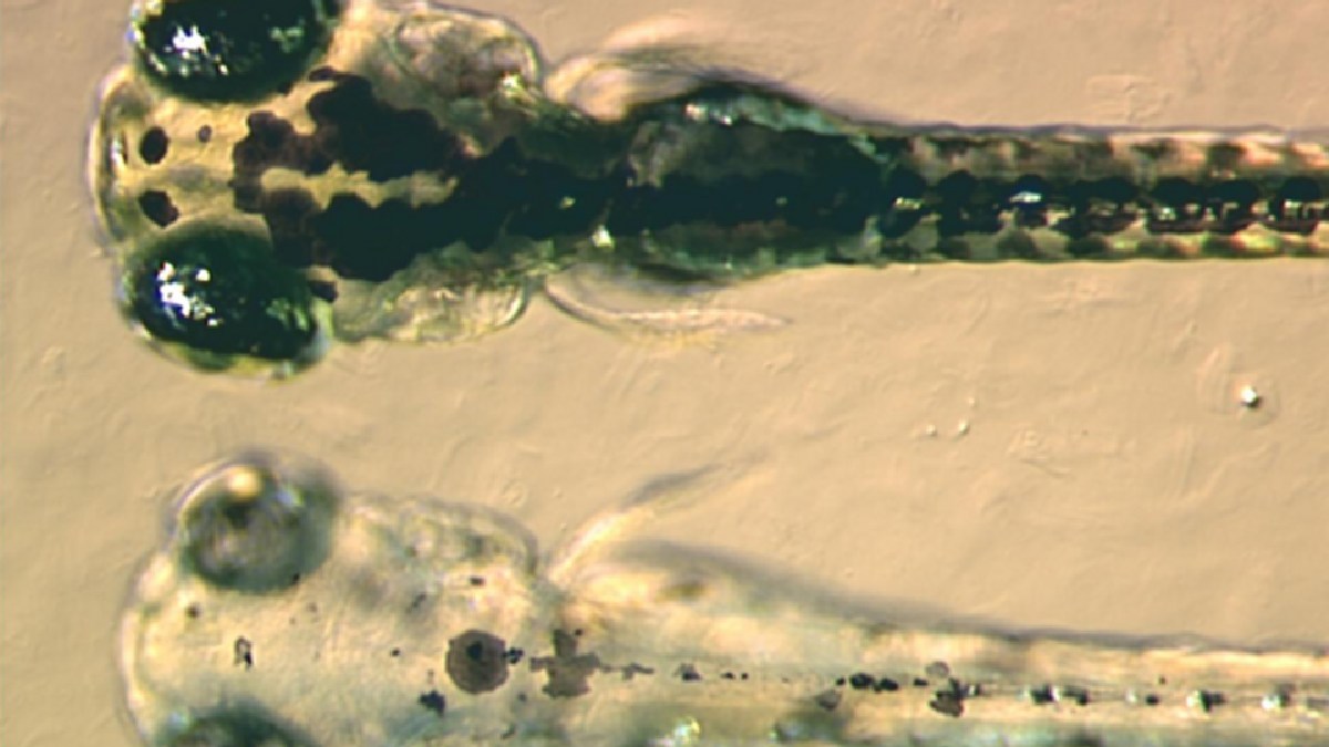 A melanina atua como um filtro, absorvendo os raios UV, dispersando a energia, impedindo danos e mutações no DNA, além de neutralizar radicais livres (Foto: Adam Amsterdam, Massachusetts Institute of Technology / Wikimedia Commons)