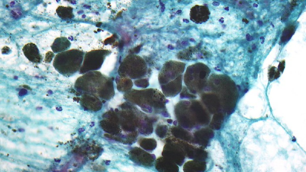 O principal mecanismo utilizado por esses seres é uma camada de melanina capaz de interagir com a radiação do ambiente (Foto: Nephron / Wikimedia Commons)