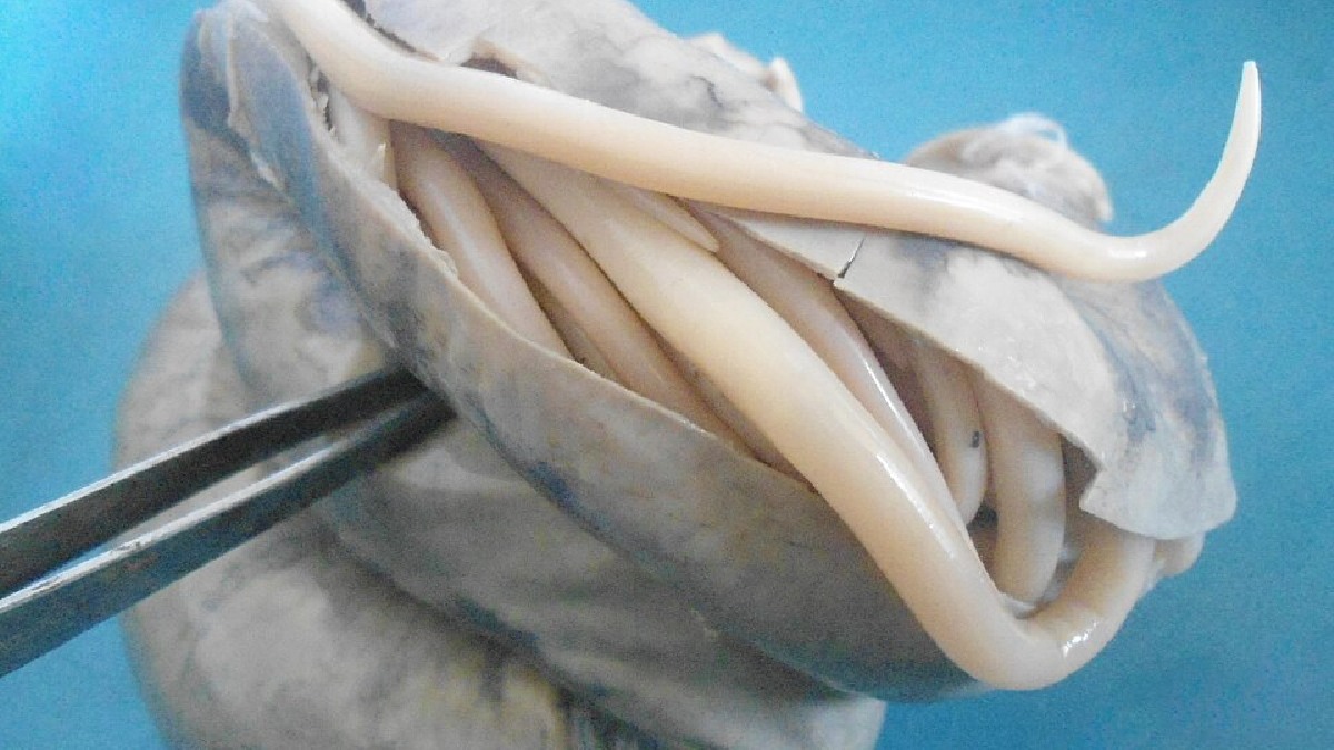 Lombrigas (Ascaris lumbricoides), cerca de 4 mil mortes por ano (Foto: Department of Pathology, Calicut Medical College / Wikimedia Commons)