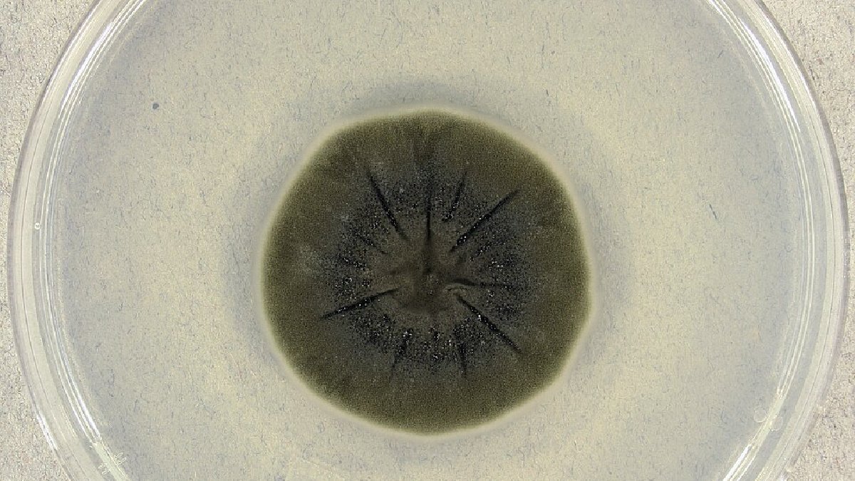 Estes são os fungos melanizados, eles incluem algumas espécies, como Cryptococcus neoformans, Wangiella/Exophiala dermatitidis, Cladosporium sphaerospermum e Cladosporium cladosporioides (Foto: Medmyco / Wikimedia Commons)