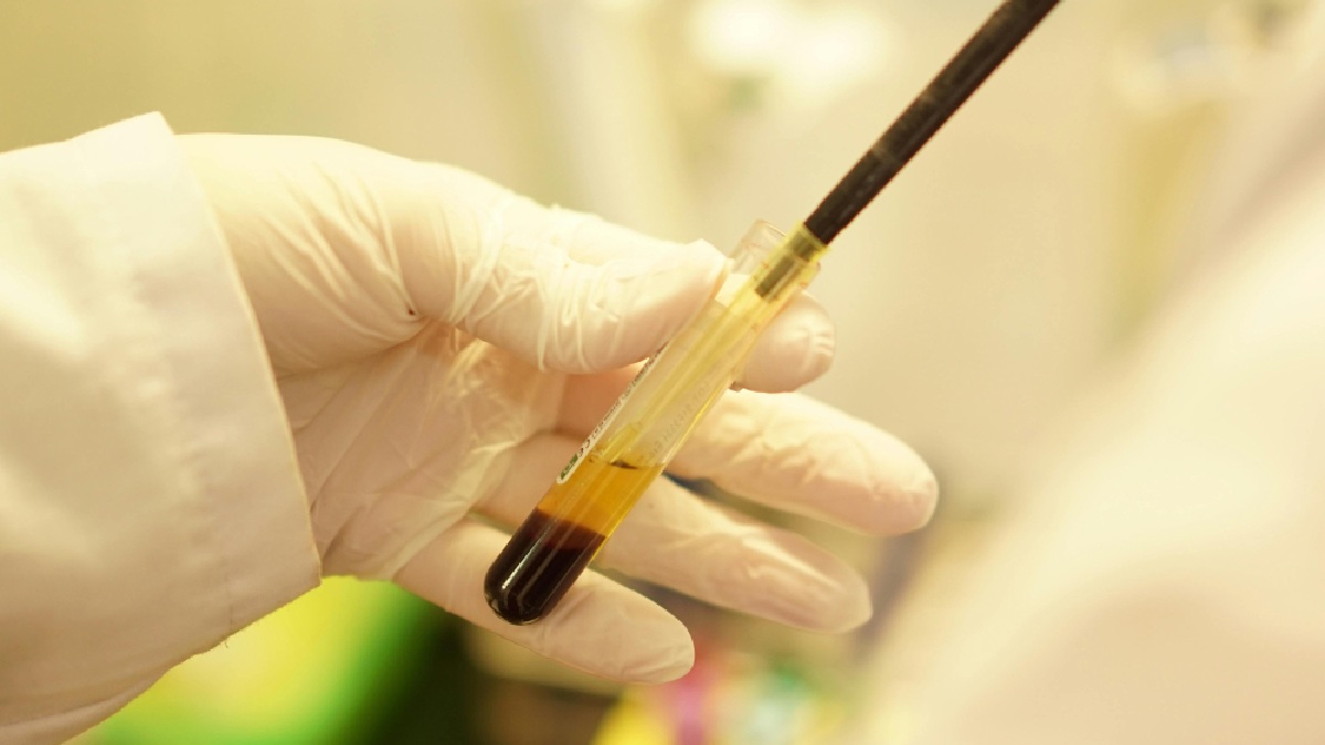 A análise é feita na busca por biomarcadores positivos dos tumores, especialmente nos estágios iniciais (Foto: bo ra / Pexels)