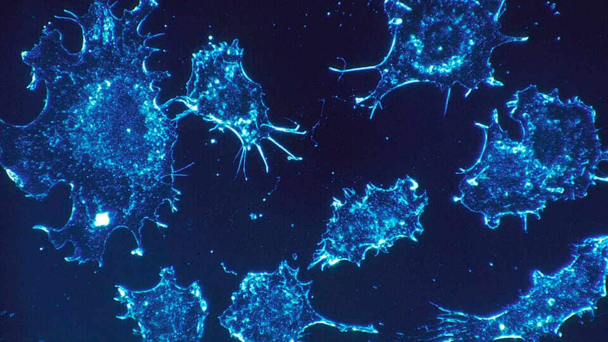 Células cancerígenas vistas em microscopia de campo escuro mostram formas irregulares e prolongamentos que ajudam a ilustrar o movimento celular estudado pela ciência (Foto: Dr. Cecil Fox / National Cancer Institute)