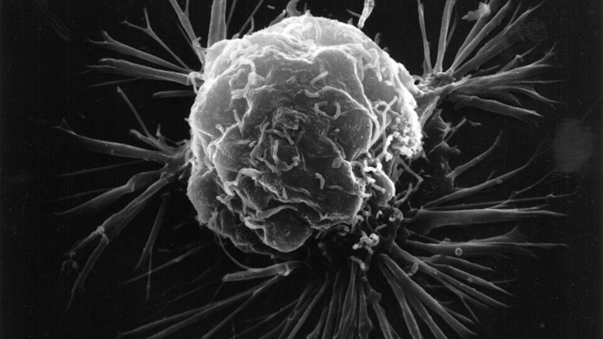 Imagem em microscopia eletrônica mostra a superfície de uma célula de câncer de mama, com detalhes que ajudam a visualizar sua interação com o ambiente ao redor (Foto: National Cancer Institute / Wikimedia Commons)