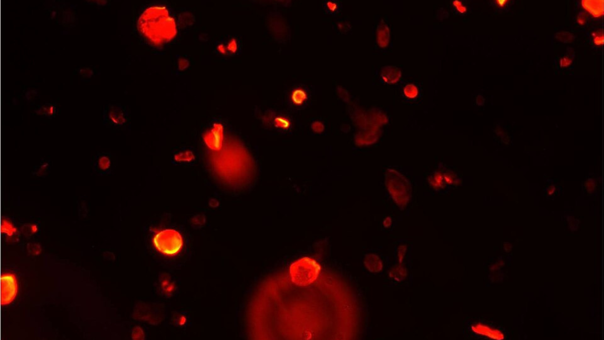 Células de câncer de cabeça e pescoço marcadas por fluorescência mostram como técnicas de imagem tornam visíveis estruturas microscópicas do tumor (Foto: Bibeh100 / Wikimedia Commons)