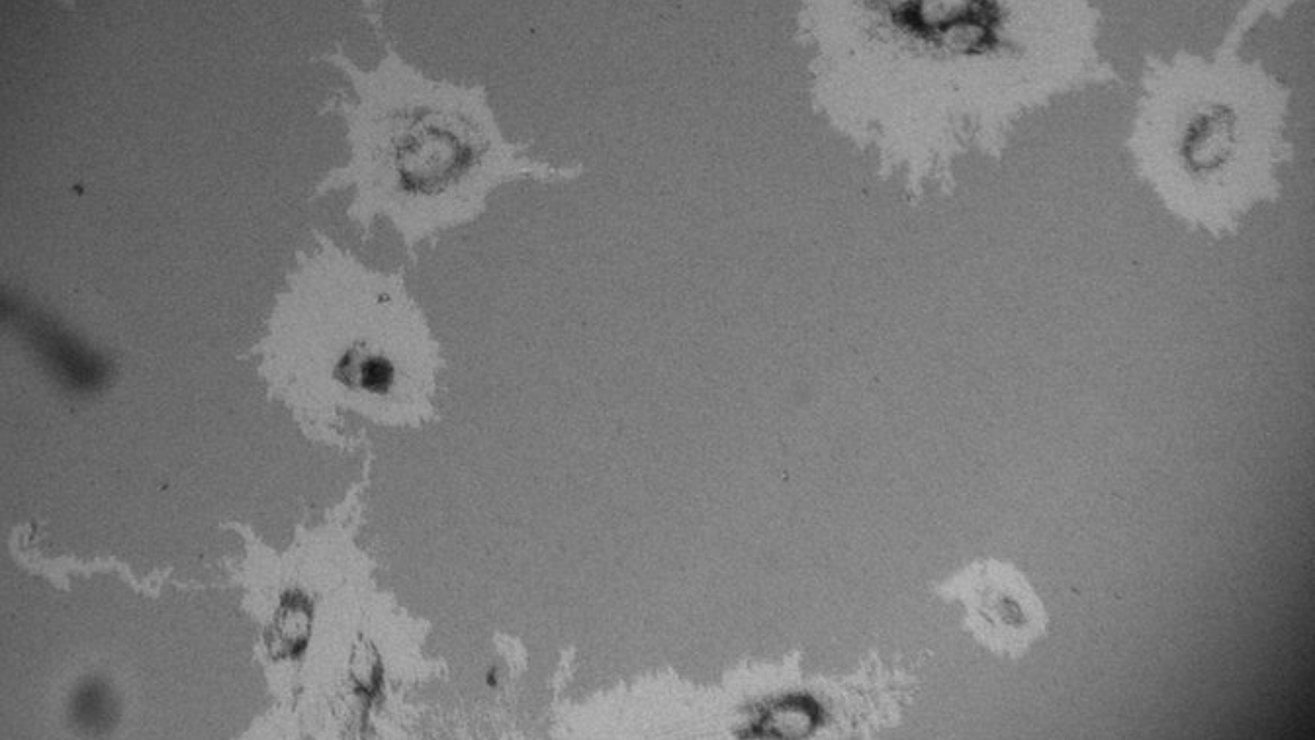 Imagem de estudo sobre migração de células de câncer de mama triplo-negativo mostra como a ciência acompanha movimentos ligados à disseminação tumoral (Foto: Koedoot et al. / Wikimedia Commons)
