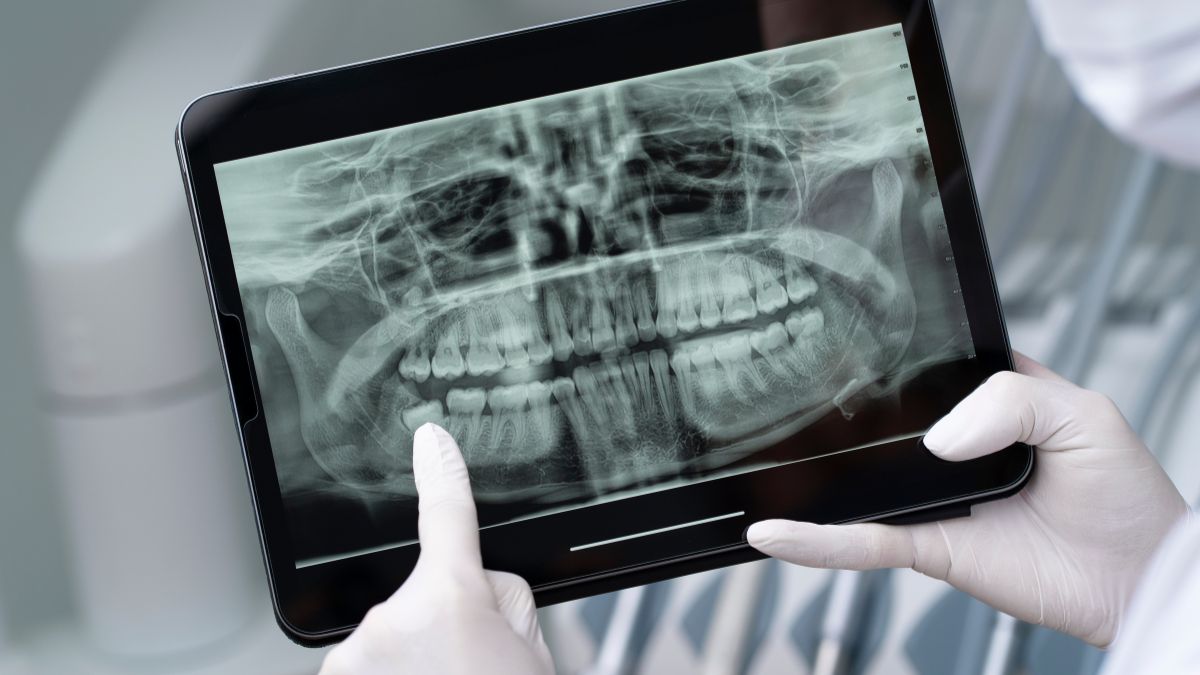 O contraste com instrumentos atuais ajuda a mostrar o quanto o cuidado dentário mudou nos últimos séculos (Foto: Pexels)