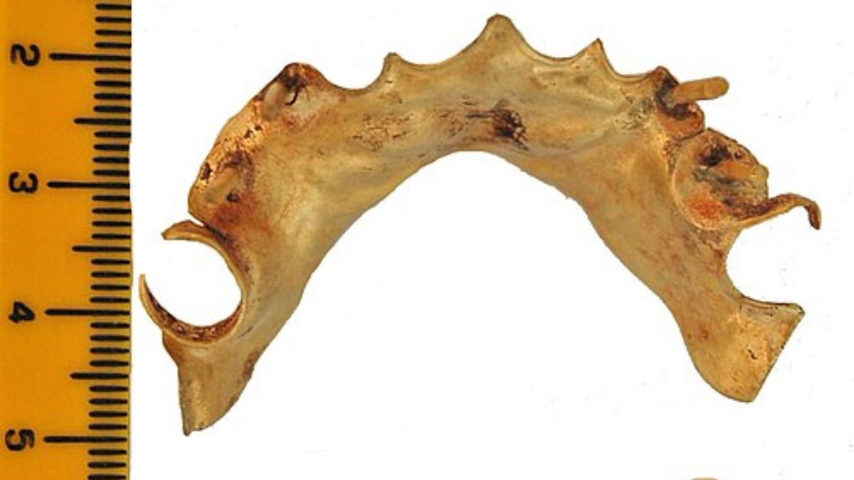 Próteses antigas mostram que substituir dentes perdidos não era apenas uma preocupação moderna (Foto: Wikimedia Commons/BDA Dental Museum)