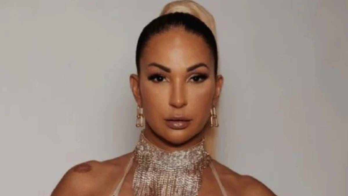 Em seu livro biográfico, Valesca Popozuda revelou arrependimento após realizar um preenchimento labial, que classificou como "desastroso". Foto: Reprodução