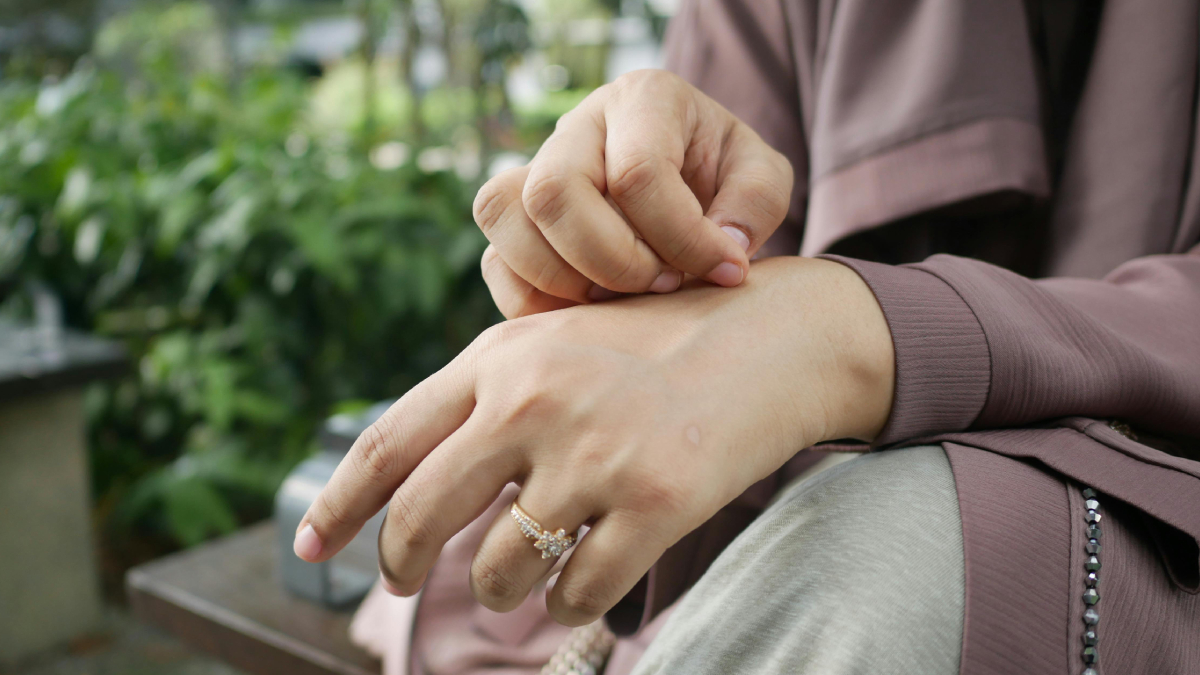 Descoberta pode ajudar pessoas que sofrem com eczema, dermatite e outras doenças de pele (Foto: Pexels)