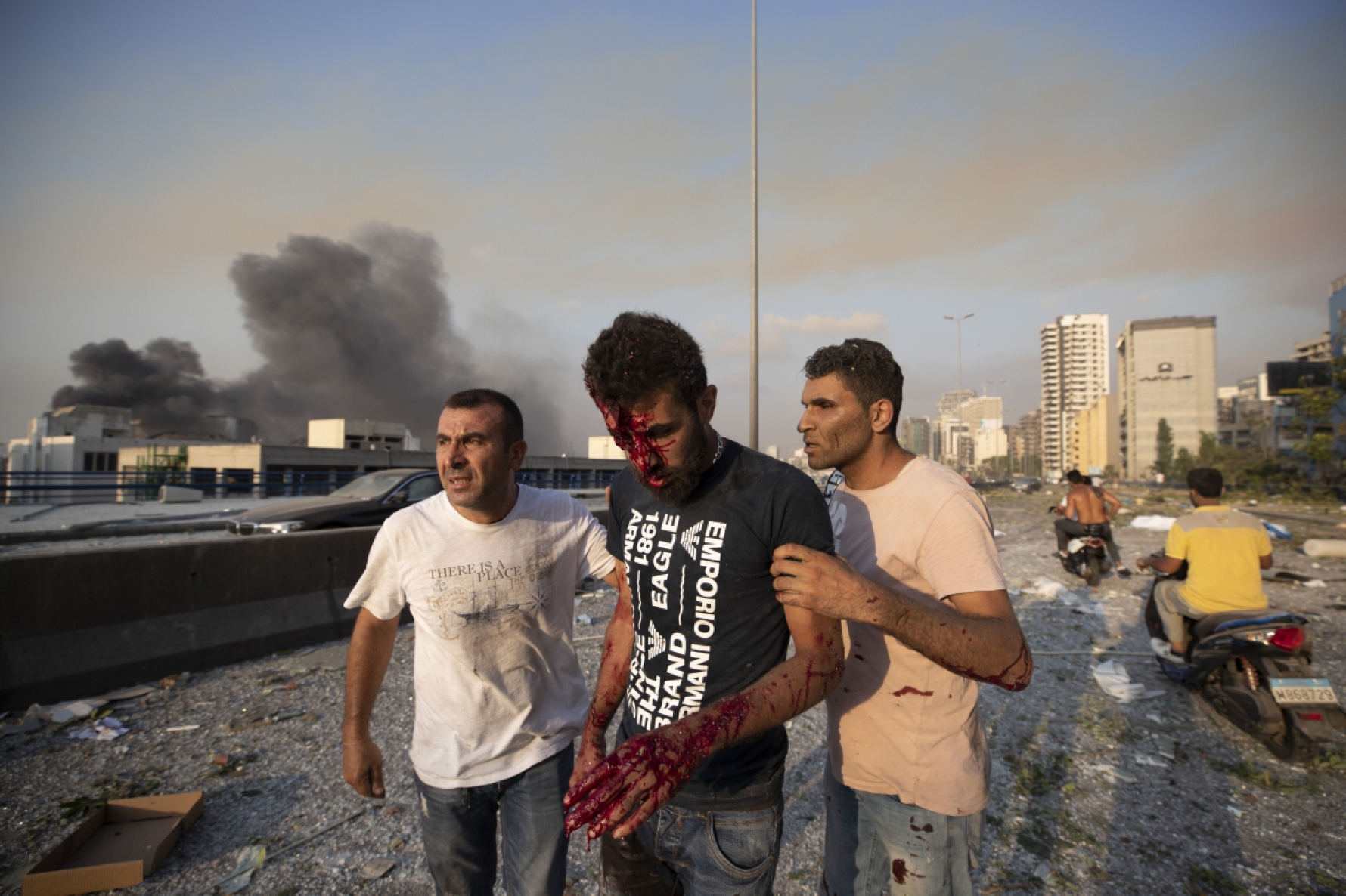 Explosão em Beirute, Líbano - Foto: Hassan Ammar/Associated Press Macaque in the trees